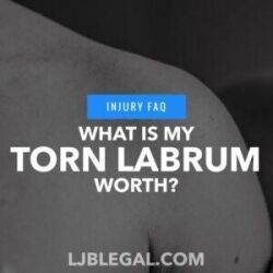 What is my torn labrum worth?