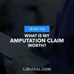 What is my Amputation Claim Worth?