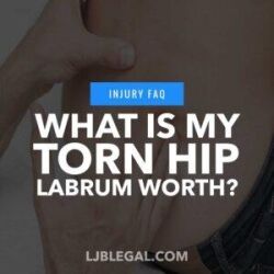 What is my Torn Hip Labrum Worth?
