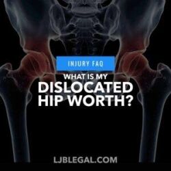 What is My Dislocated Hip Worth?