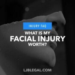 What is my facial injury worth?