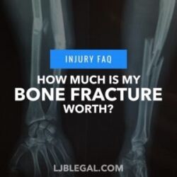 How Much is my Bone Fracture Worth?