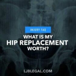 What is my hip replacement worth?