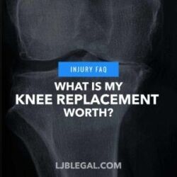 What is my knee replacement worth?
